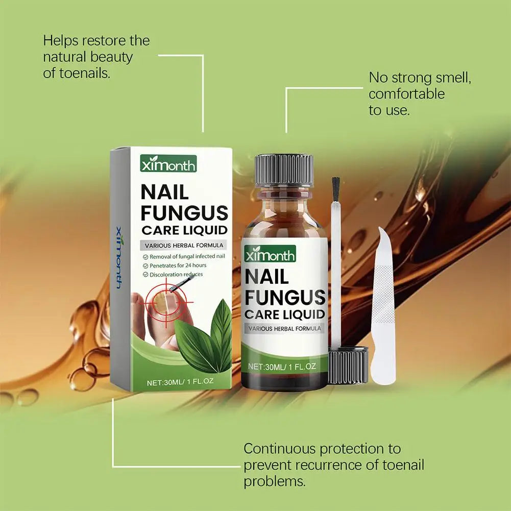 Onychomycosis Hand Foot Removal Repair Care Nail Fungal Treatment Serum Anti Infection Toe Fungus Paronychia 50g