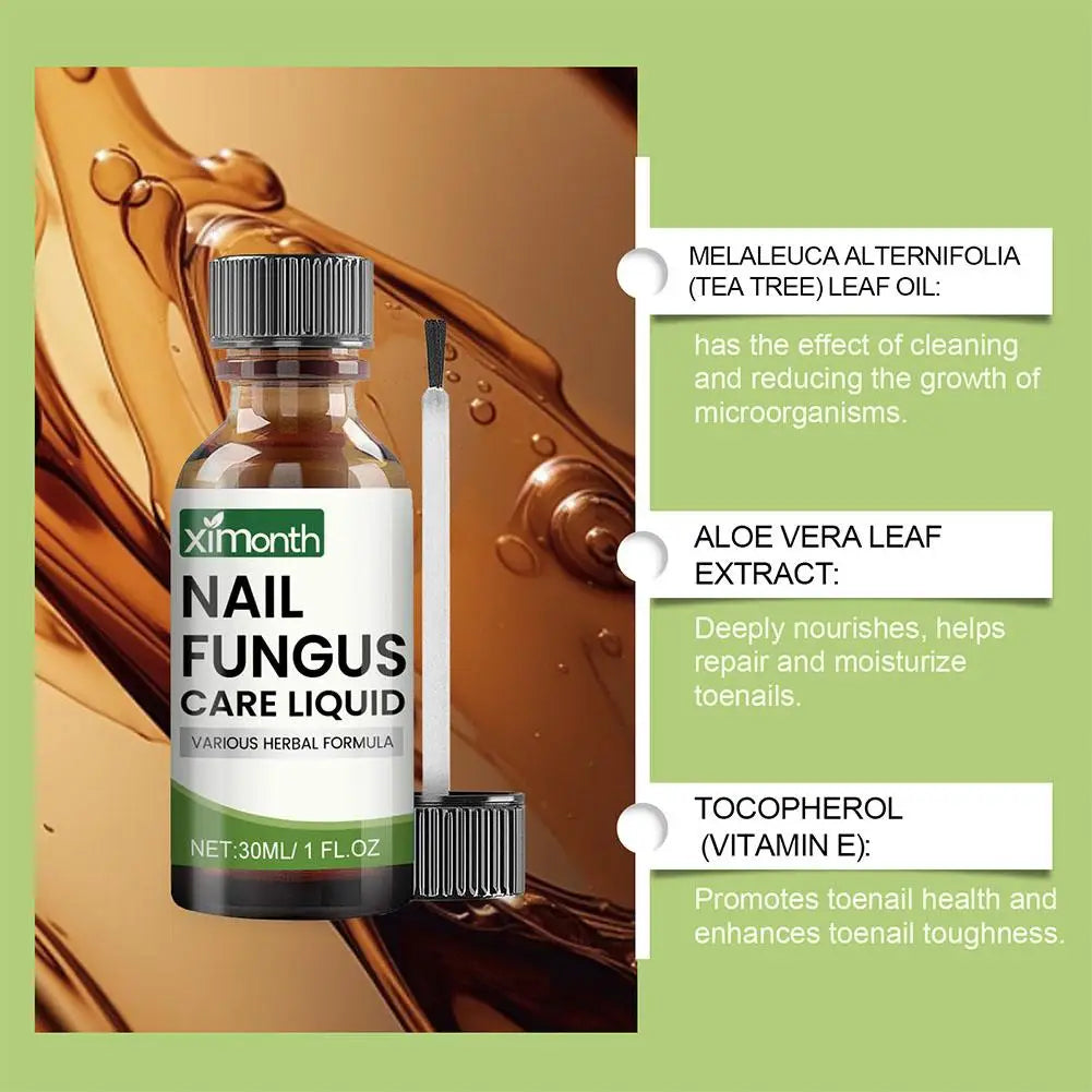 Onychomycosis Hand Foot Removal Repair Care Nail Fungal Treatment Serum Anti Infection Toe Fungus Paronychia 50g