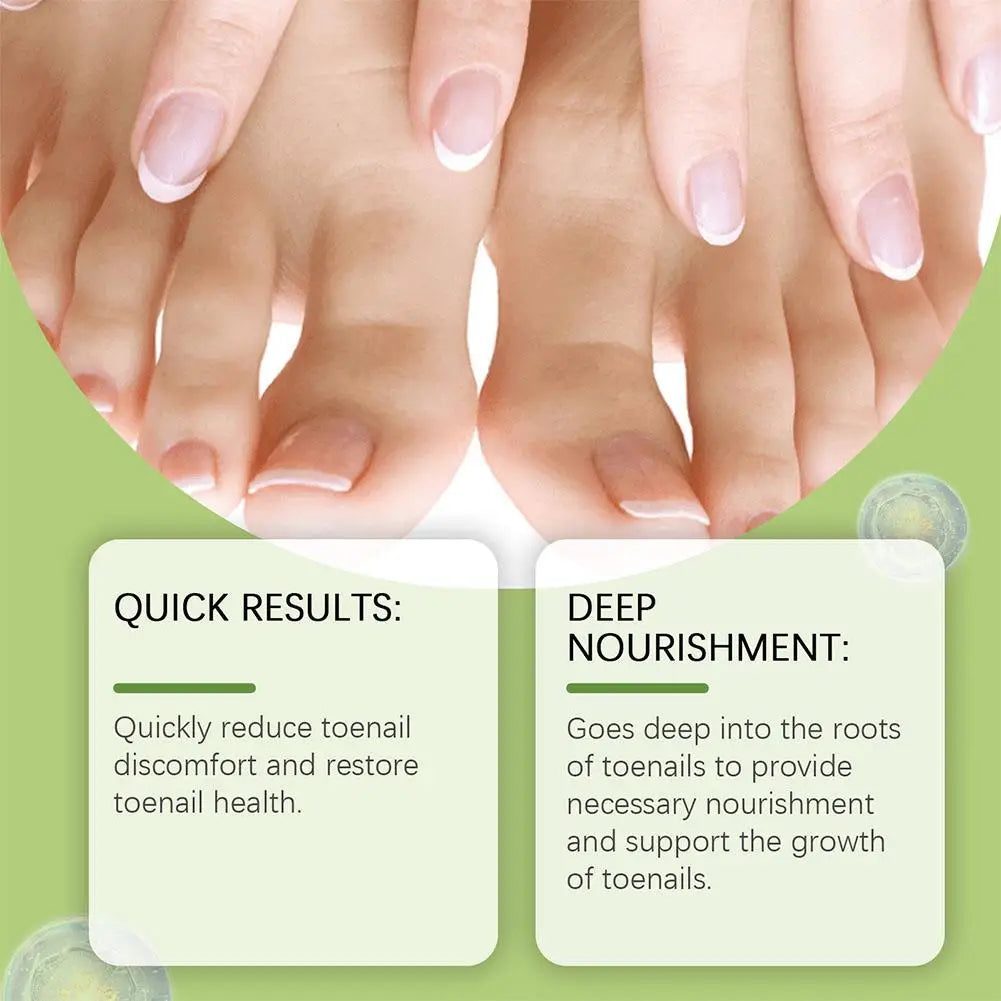 Onychomycosis Hand Foot Removal Repair Care Nail Fungal Treatment Serum Anti Infection Toe Fungus Paronychia 50g