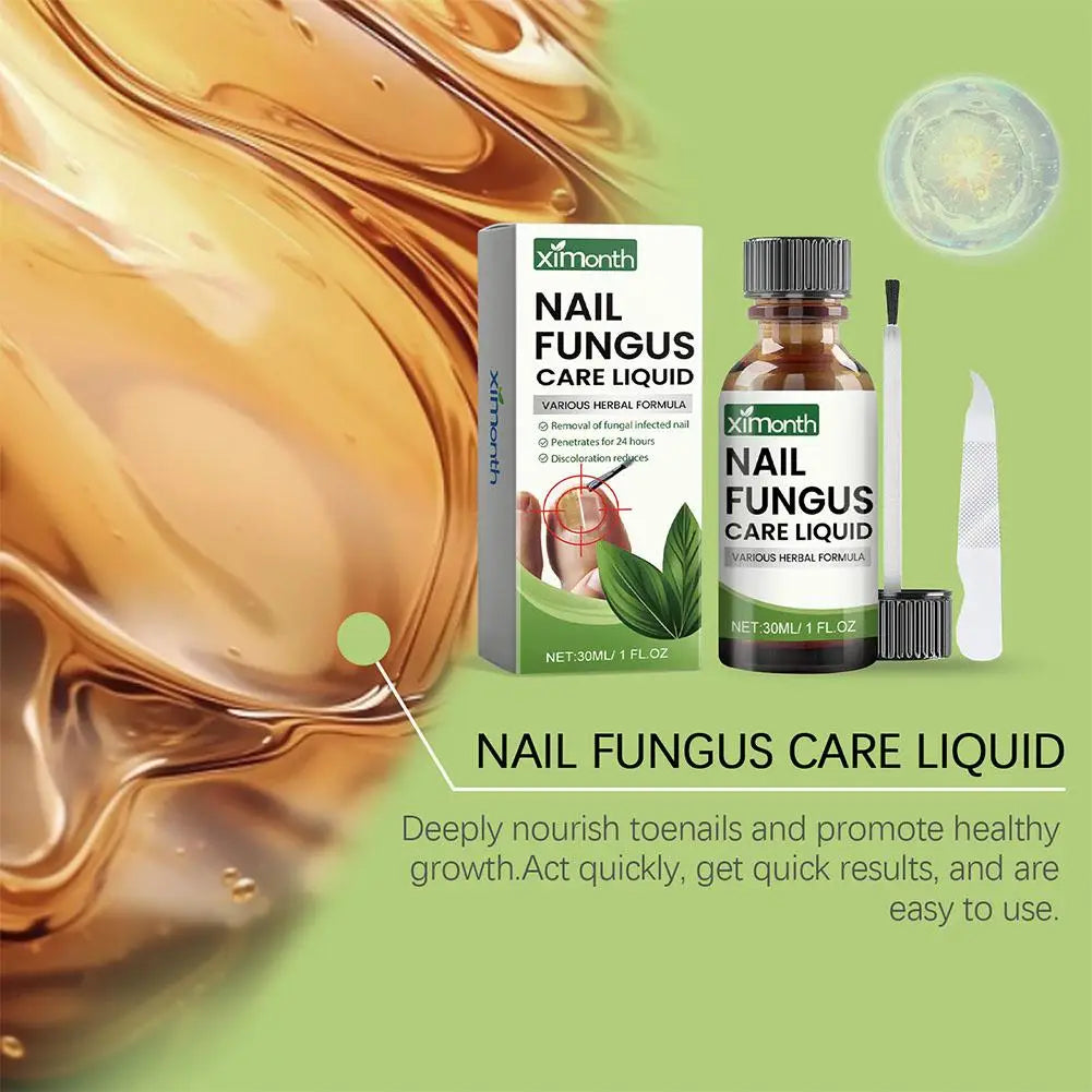 Onychomycosis Hand Foot Removal Repair Care Nail Fungal Treatment Serum Anti Infection Toe Fungus Paronychia 50g