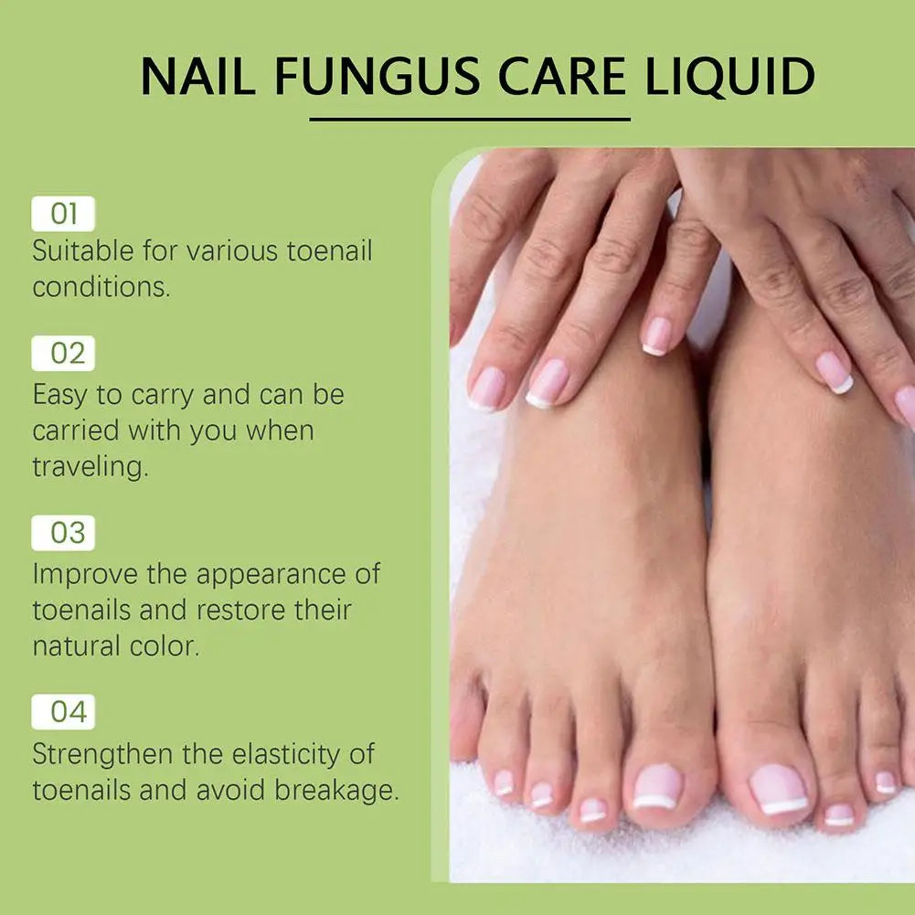 Onychomycosis Hand Foot Removal Repair Care Nail Fungal Treatment Serum Anti Infection Toe Fungus Paronychia 50g